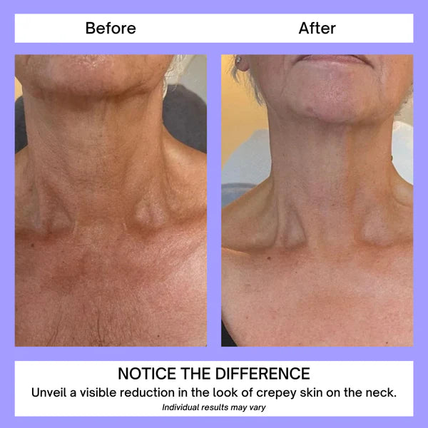 💜2x1 Neck Crema® Reafirmante Antienvejecimiento-Compra 1 y llévate 2💜