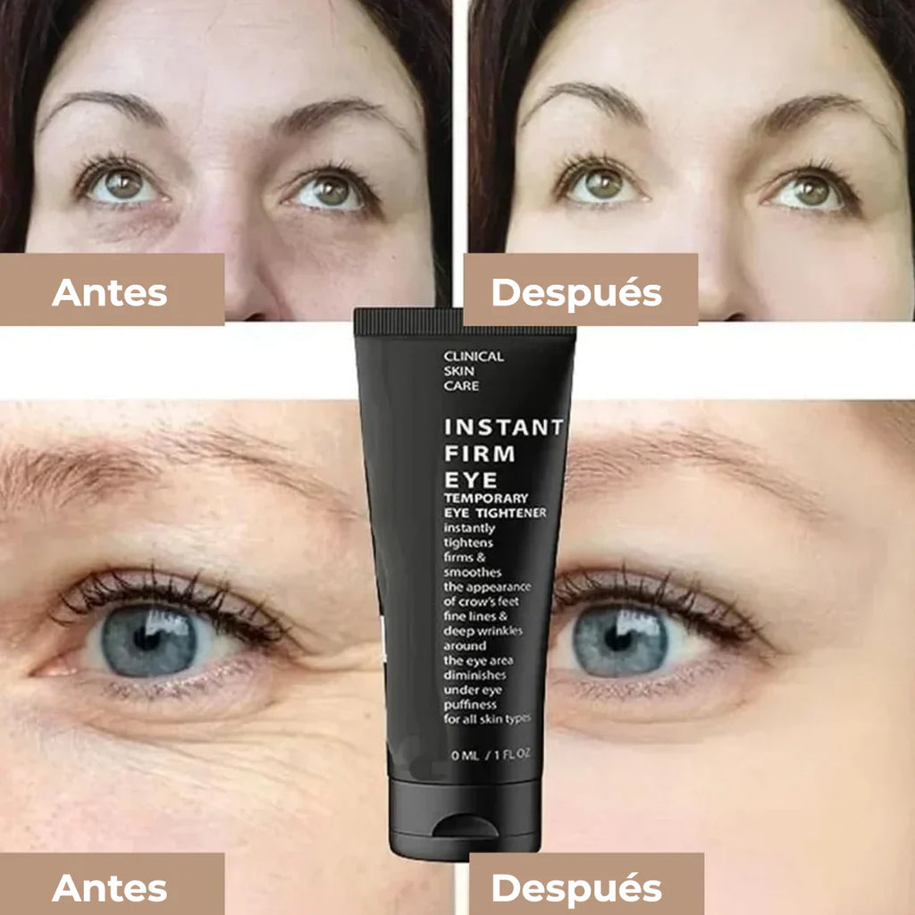 PACK 2 UNIDADES - CELYN™(30ml) 🧴¡ Crema para Ojos Rejuvenece Tu Mirada ! 👁️✨