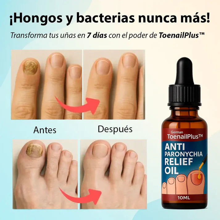 PACK 2 UNIDADES Anti Hongos Uñas - German Toenail Plus™ 2UND 30ml👋🦠