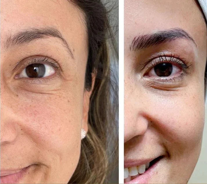Kit Retinol Bioaqua💜®️- Renovación Celular - Caja De Lujo x6 Productos