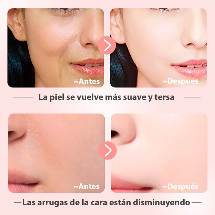 Kit Nicotinamida🧬- Aclarante Reparador - Caja De Lujo Bioaqua x6 Productos – Cuidado Facial – SkinCare